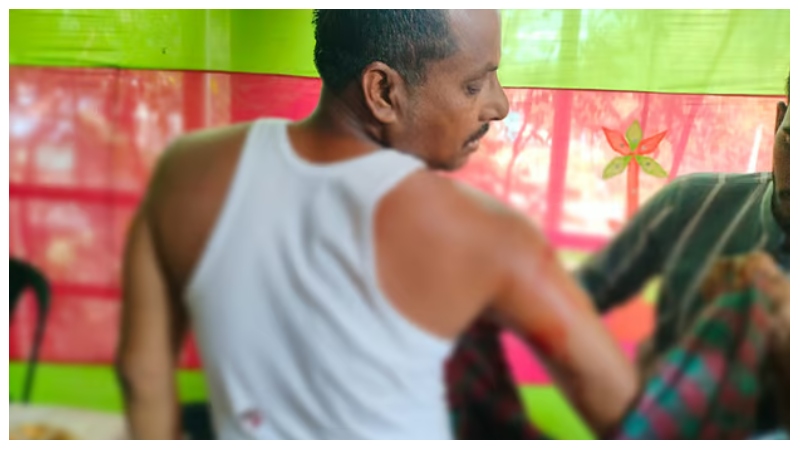 দাওয়াত খেতে গিয়ে হামলার শিকার আওয়ামী লীগের নেতা