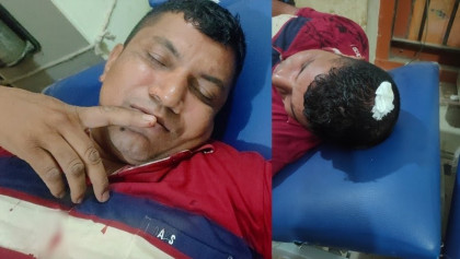 কুষ্টিয়ার মিরপুরে পালানোর চেষ্টায় দুই পুলিশ সদস্যকে হাতুড়িপেটা করলো আসামি