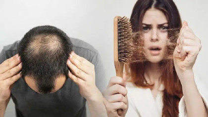 যেসব পরিবর্তন আনলে চুল পড়া কমবে