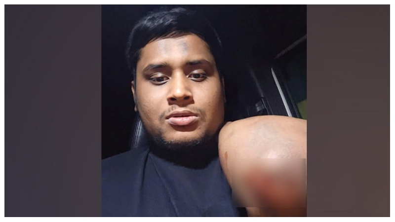 রক্তাক্ত হাসনাত আব্দুল্লাহ ! যেভাবে করা হয় হামলা