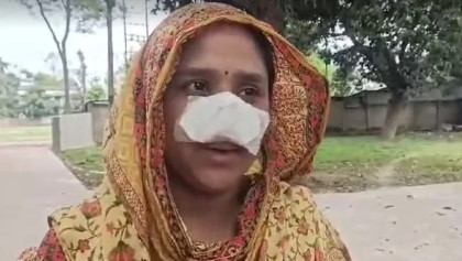 স্ত্রীর নাক সুন্দর বলে রেগে গিয়ে কামড়ে দিলেন স্বামী!